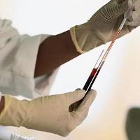 Normen for blodprøven, hva er dens betydning
